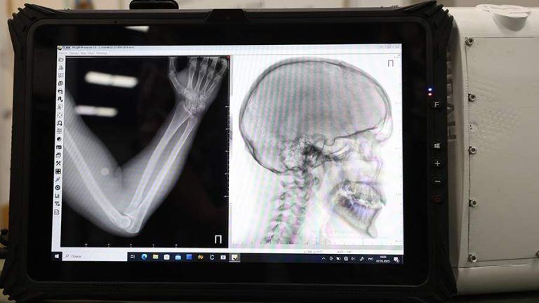 SCMP узнало о разработке технологии ИИ для создания 3D-моделей костей и органов